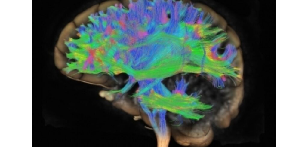 Medicamentul revoluționar împotriva Alzheimer: vindecă cu adevărat boala, nu este doar ameliorator