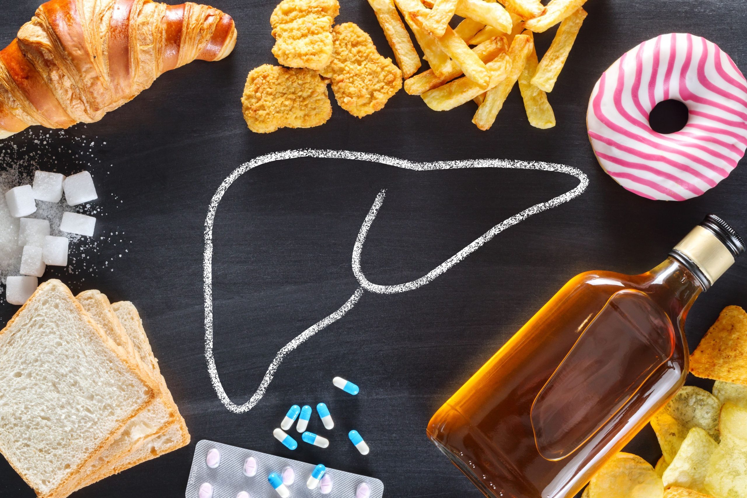 Cele 5 alimente pe care niciun nutriționist nu le-ar mânca. Unul dintre ele e consumat aproape zilnic de toți românii Cele 5 alimente pe care niciun nutriționist nu le-ar mânca. Unul dintre ele e consumat aproape zilnic de toți românii