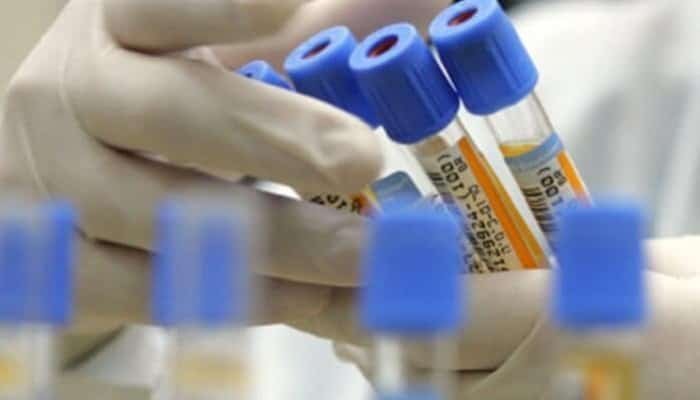 CNAS: De la 1 iulie, pacienții asigurați și neasigurați vor beneficia de noi servicii pentru depistarea unor boli grave CNAS: De la 1 iulie, pacienții asigurați și neasigurați vor beneficia de noi servicii pentru depistarea unor boli grave
