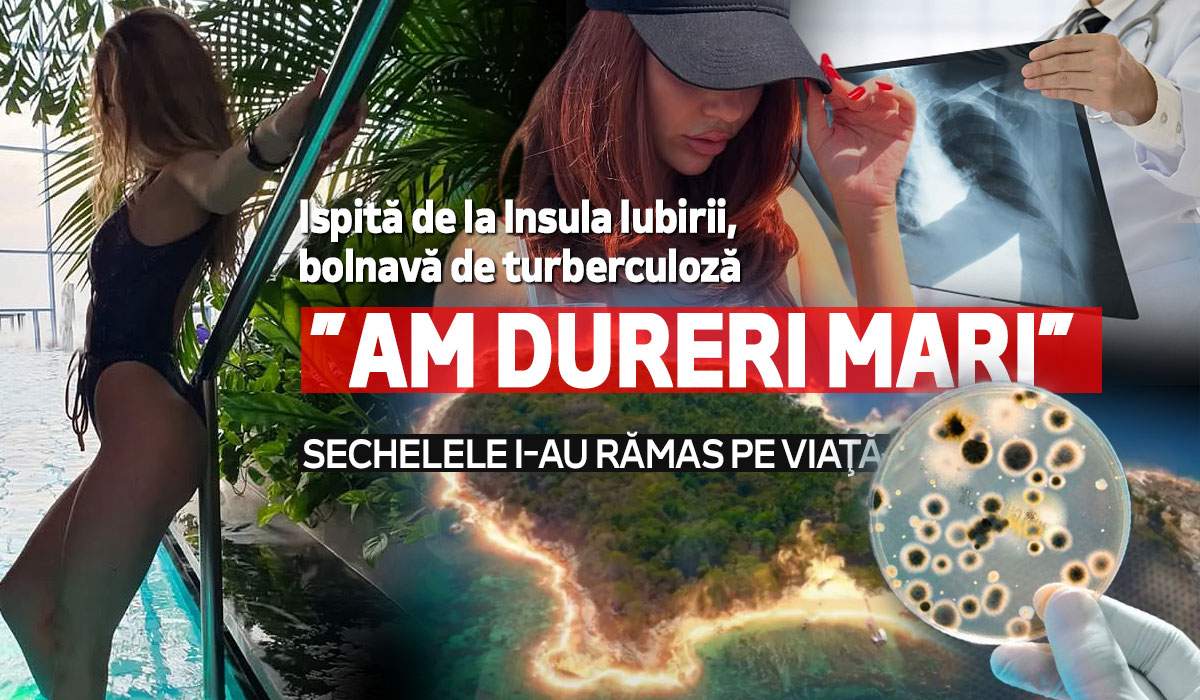 Ispită de la Insula Iubirii, bolnavă de tuberculoză. ”Am dureri mari”. Sechelele i-au rămas pe viaţă