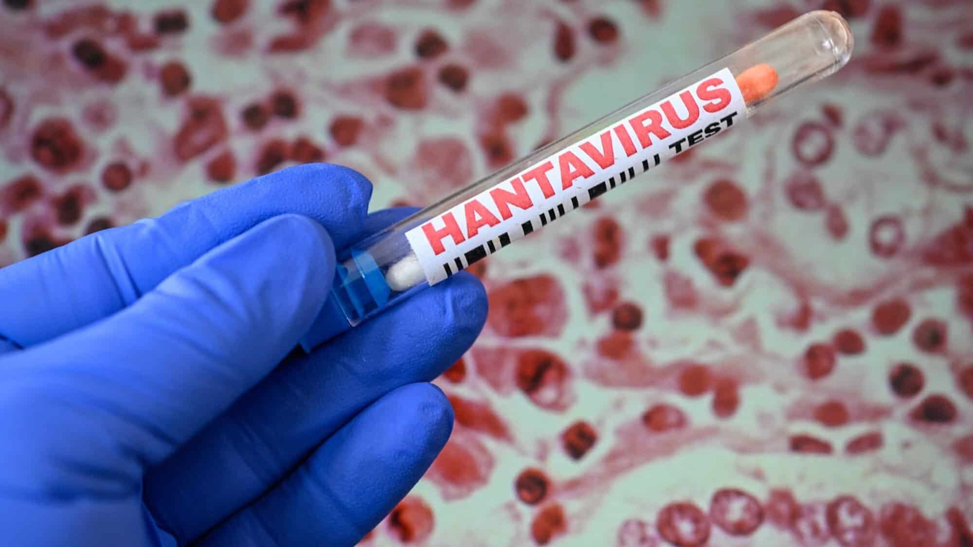 Hantavirus confirmat pentru prima dată în România de la focarul care a îngrozit lumea. Poziția INSP