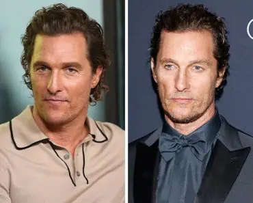 Jim Carrey și Matthew McConaughey au apărut în ultimele luni cu trăsături vizibil diferite. Un medic explică motivul real pentru care unii actori de la Hollywood par „de nerecunoscut”