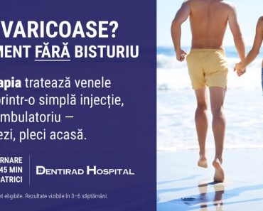Dentirad Hospital: Scapi de varice fără bisturiu. Scleroterapia — tratament minim-invaziv Dentirad Hospital: Scapi de varice fără bisturiu. Scleroterapia — tratament minim-invaziv