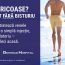 Dentirad Hospital: Scapi de varice fără bisturiu. Scleroterapia — tratament minim-invaziv