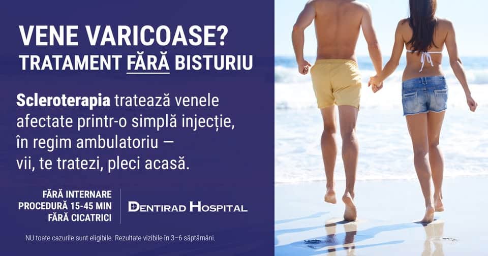 Dentirad Hospital: Scapi de varice fără bisturiu. Scleroterapia — tratament minim-invaziv