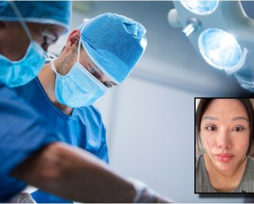 Operația estetică ce i-a ruinat viața unei femei: nu-și mai poate închide ochii nici în somn. Ce au descoperit autoritățile?