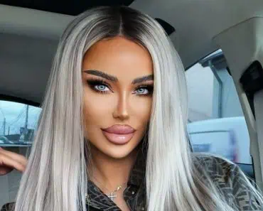 Bianca Drăgușanu s-a operat din nou. Vedeta a apărut cu capul bandajat: „Am făcut-o și pe asta!”