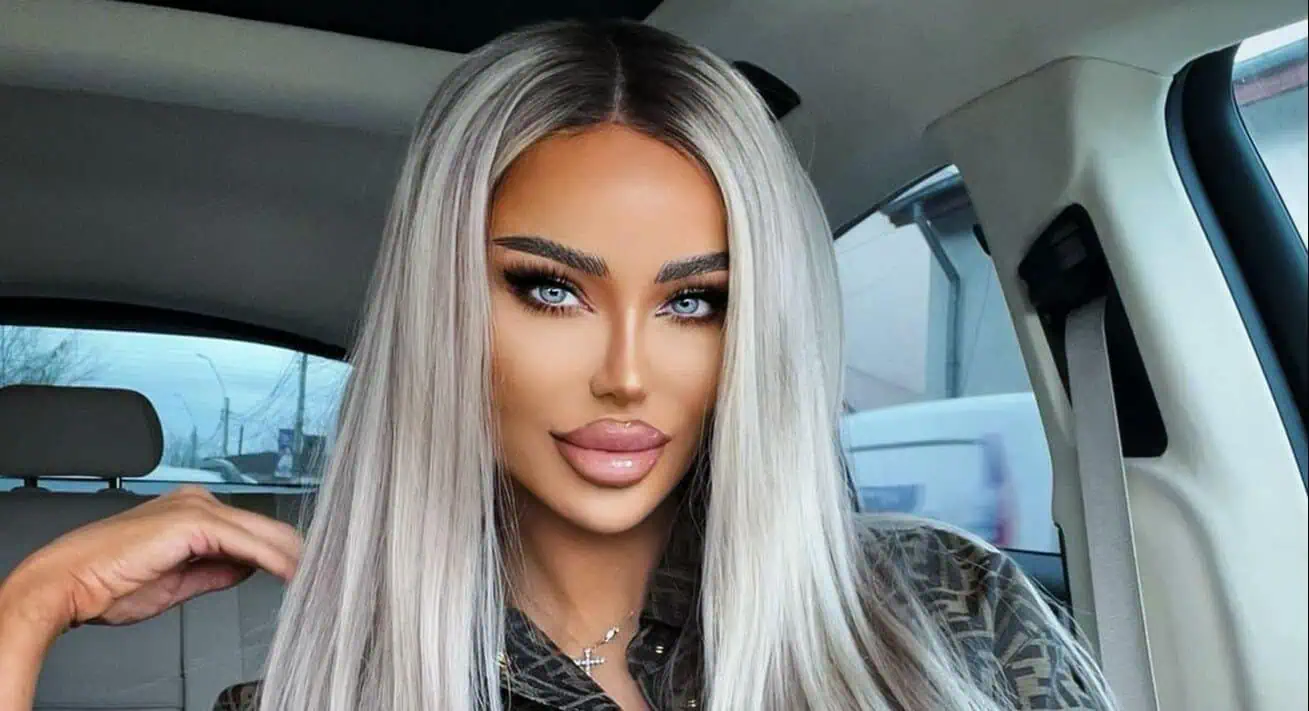 Bianca Drăgușanu s-a operat din nou. Vedeta a apărut cu capul bandajat: „Am făcut-o și pe asta!”