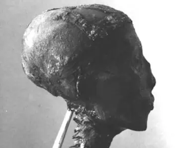 Secretul tulburător al mumiei lui Tutankhamon. De ce i-a fost desprins capul și apoi lipit la loc Secretul tulburător al mumiei lui Tutankhamon. De ce i-a fost desprins capul și apoi lipit la loc