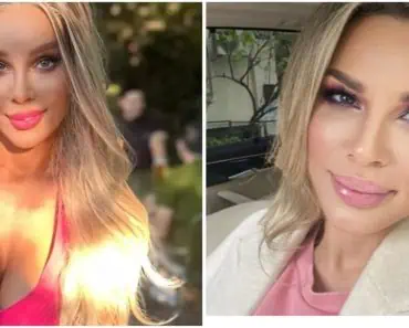 Alina Laufer, pusă la zid după ce și-a operat fața: „Comentariile au fost deplasate”