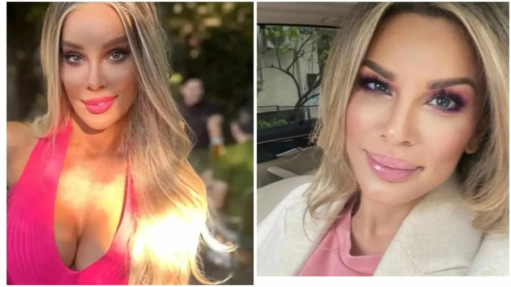 Alina Laufer, pusă la zid după ce și-a operat fața: „Comentariile au fost deplasate” Alina Laufer, pusă la zid după ce și-a operat fața: „Comentariile au fost deplasate”