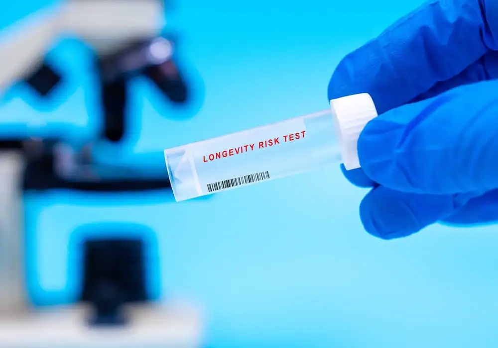 Medicina longevității: 6 analize pe care să le faci ca să înțelegi cum funcționează corpul tău și cum să înaintezi în vârstă sănătos și cu energie Medicina longevității: 6 analize pe care să le faci ca să înțelegi cum funcționează corpul tău și cum să înaintezi în vârstă sănătos și cu energie