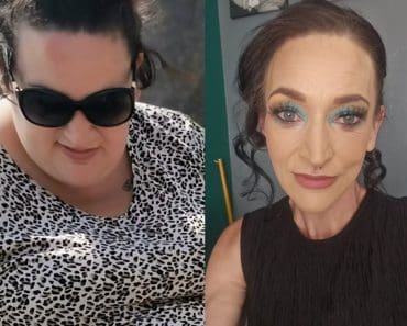 „Aș fi murit curând”. De la 159 la 66 de kilograme! Cum a reușit o femeie să slăbească atât de mult „Aș fi murit curând”. De la 159 la 66 de kilograme! Cum a reușit o femeie să slăbească atât de mult