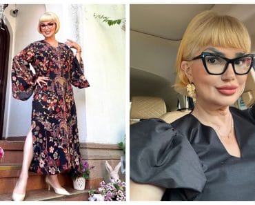 Ozana Barabancea, primele vești după liftingul facial. Cum arată vedeta: „Sunt foarte fericită”