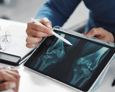 Medici: Probabil cel mai bun aliment pentru oase puternice Medici: Probabil cel mai bun aliment pentru oase puternice