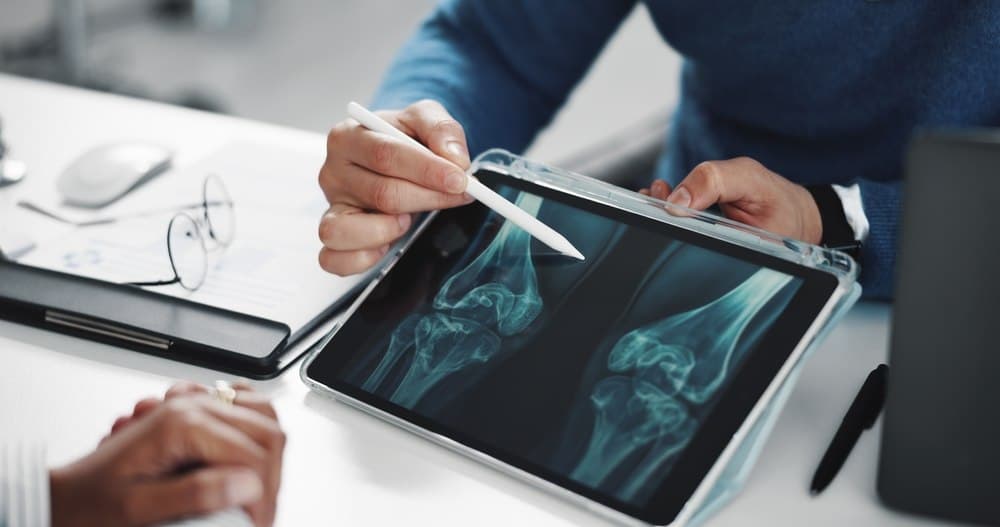 Medici: Probabil cel mai bun aliment pentru oase puternice