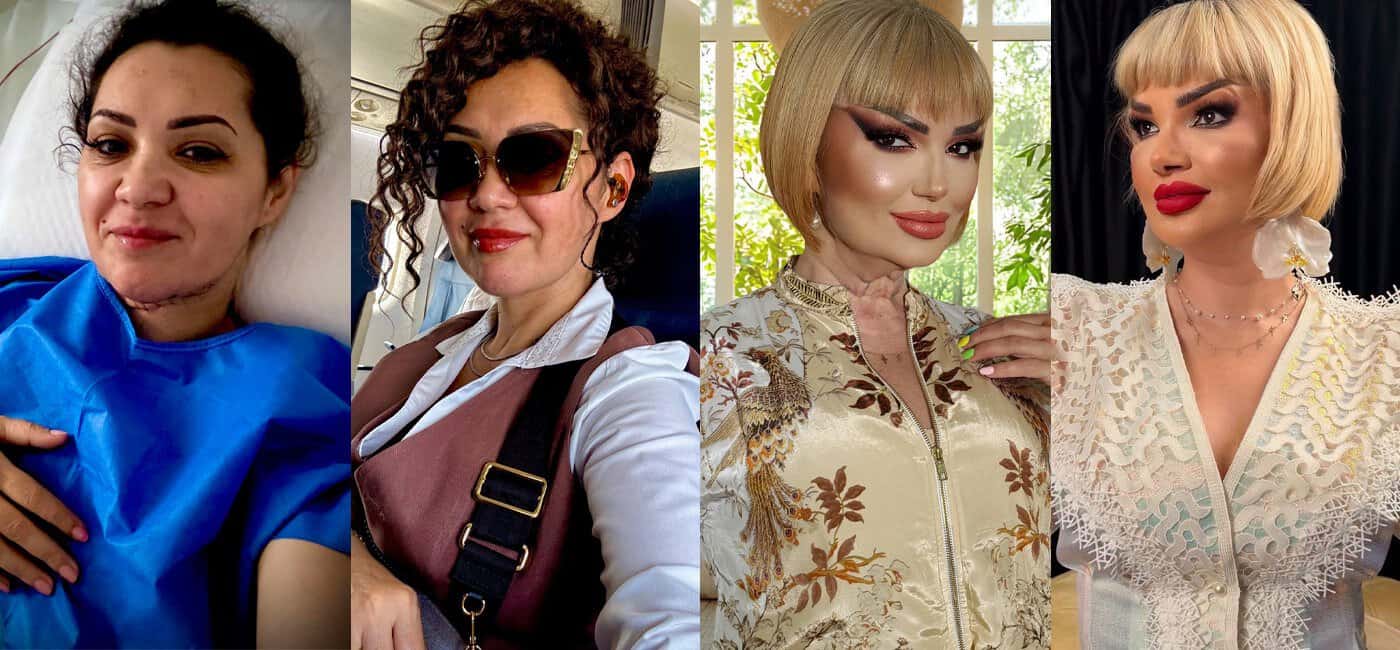 Mai tinere cu 10 ani, după operația estetică la gât! Sfatul designerilor pentru Minodora și Ozana Barabancea: „Pot purta din nou decolteuri” Mai tinere cu 10 ani, după operația estetică la gât! Sfatul designerilor pentru Minodora și Ozana Barabancea: „Pot purta din nou decolteuri”
