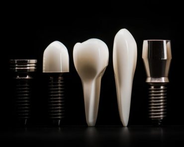 Unde să îți faci implant dentar în Timișoara